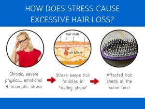 hair-loss-stress